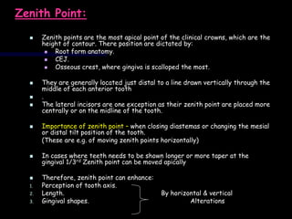 Zenith Shape Guide ESTHETICS-MINAL.ppt