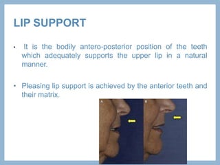 Esthetics in complete dentur.pptx