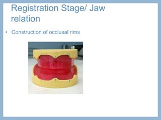 Partial Registration Rim Esthetics in complete dentur.pptx