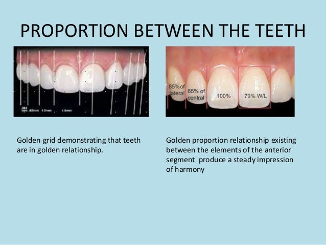 Esthetics in complete denture