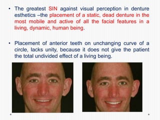 • The greatest SIN against visual perception in denture
esthetics –the placement of a static, dead denture in the
most mobile and active of all the facial features in a
living, dynamic, human being.
• Placement of anterior teeth on unchanging curve of a
circle, lacks unity, because it does not give the patient
the total undivided effect of a living being.
 