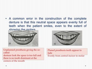 • A common error in the construction of the complete
denture is that this neutral space appears evenly full of
teeth when the patient smiles, even to the extent of
showing the molars.
Unplanned prosthesis giving the so-
called
denture look the space is too full and
there is no tooth dominant at the
corners of the mouth
Planed prosthesis teeth appear to
fade
Evenly from central incisor to molar
 
