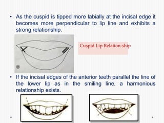 • As the cuspid is tipped more labially at the incisal edge it
becomes more perpendicular to lip line and exhibits a
strong relationship.
• If the incisal edges of the anterior teeth parallel the line of
the lower lip as in the smiling line, a harmonious
relationship exists.
Cuspid Lip Relation-ship
 