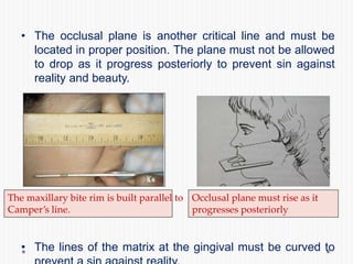 • The occlusal plane is another critical line and must be
located in proper position. The plane must not be allowed
to drop as it progress posteriorly to prevent sin against
reality and beauty.
• The lines of the matrix at the gingival must be curved to
The maxillary bite rim is built parallel to
Camper’s line.
Occlusal plane must rise as it
progresses posteriorly
 