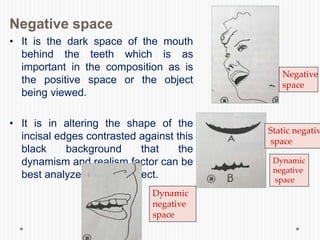 Negative space
• It is the dark space of the mouth
behind the teeth which is as
important in the composition as is
the positive space or the object
being viewed.
• It is in altering the shape of the
incisal edges contrasted against this
black background that the
dynamism and realism factor can be
best analyzed for their effect.
Negative
space
Static negativ
space
Dynamic
negative
space
Dynamic
negative
space
 