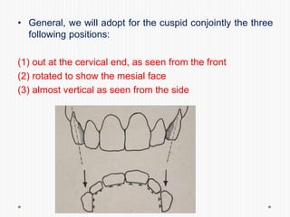 • General, we will adopt for the cuspid conjointly the three
following positions:
(1) out at the cervical end, as seen from the front
(2) rotated to show the mesial face
(3) almost vertical as seen from the side
 