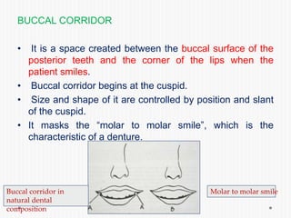 BUCCAL CORRIDOR
• It is a space created between the buccal surface of the
posterior teeth and the corner of the lips when the
patient smiles.
• Buccal corridor begins at the cuspid.
• Size and shape of it are controlled by position and slant
of the cuspid.
• It masks the “molar to molar smile”, which is the
characteristic of a denture.
Buccal corridor in
natural dental
composition
Molar to molar smile
 