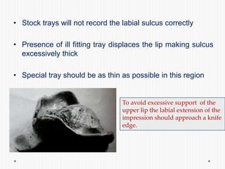 • Stock trays will not record the labial sulcus correctly
• Presence of ill fitting tray displaces the lip making sulcus
excessively thick
• Special tray should be as thin as possible in this region
To avoid excessive support of the
upper lip the labial extension of the
impression should approach a knife
edge.
 