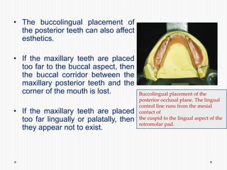 • The buccolingual placement of
the posterior teeth can also affect
esthetics.
• If the maxillary teeth are placed
too far to the buccal aspect, then
the buccal corridor between the
maxillary posterior teeth and the
corner of the mouth is lost.
• If the maxillary teeth are placed
too far lingually or palatally, then
they appear not to exist.
Buccolingual placement of the
posterior occlusal plane. The lingual
control line runs from the mesial
contact of
the cuspid to the lingual aspect of the
retromolar pad.
 
