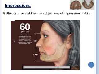 Impressions
Esthetics is one of the main objectives of impression making.
 