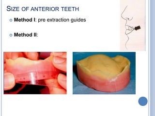 SIZE OF ANTERIOR TEETH
 Method I: pre extraction guides
 Method II:
 