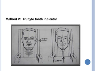 Method V: Trubyte tooth indicator
 