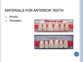 MATERIALS FOR ANTERIOR TEETH
A) Acrylic.
B) Porcelain.
 