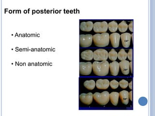 Form of posterior teeth
• Anatomic
• Semi-anatomic
• Non anatomic
 