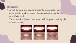 Photographs
• Are of far more help in determining the placement of anterior
teeth, arch form, & lip support than the actual size or the mould of
an artificial teeth.
• The most valuable one is a close-up with the patient smiling (the
most recent one).
 