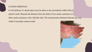 CANINE EMINENCE
If well defined; it’s distal aspect may be taken as the mesiodistal width of the maxillary
anterior teeth. Measure the distance from the distal of one canine eminence to the distal of
other canine eminence with a flexible ruler. The measurement obtained indicates the total
width of maxillary anterior teeth.
 