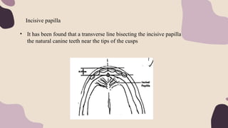 Incisive papilla
• It has been found that a transverse line bisecting the incisive papilla contacts
the natural canine teeth near the tips of the cusps
 