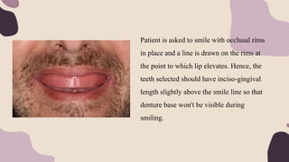 Patient is asked to smile with occlusal rims
in place and a line is drawn on the rims at
the point to which lip elevates. Hence, the
teeth selected should have inciso-gingival
length slightly above the smile line so that
denture base won't be visible during
smiling.
 