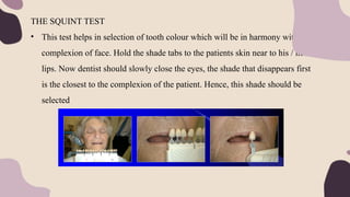 THE SQUINT TEST
• This test helps in selection of tooth colour which will be in harmony with
complexion of face. Hold the shade tabs to the patients skin near to his / her
lips. Now dentist should slowly close the eyes, the shade that disappears first
is the closest to the complexion of the patient. Hence, this shade should be
selected
 