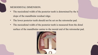 MESIODISTAL DIMENSION.
• The mesiodistal width of the posterior teeth is determined by the length &
slope of the mandibular residual ridge.
• The lower posterior teeth should not be set on the retromolar pad.
• The mesiodistal width of the posterior teeth is measured from the distal
surface of the mandibular canine to the mesial end of the retromolar pad.
 
