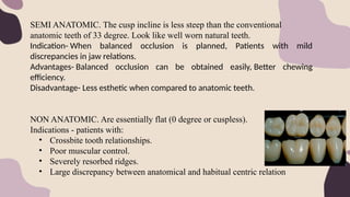 SEMI ANATOMIC. The cusp incline is less steep than the conventional
anatomic teeth of 33 degree. Look like well worn natural teeth.
Indication- When balanced occlusion is planned, Patients with mild
discrepancies in jaw relations.
Advantages- Balanced occlusion can be obtained easily, Better chewing
efficiency.
Disadvantage- Less esthetic when compared to anatomic teeth.
NON ANATOMIC. Are essentially flat (0 degree or cuspless).
Indications - patients with:
• Crossbite tooth relationships.
• Poor muscular control.
• Severely resorbed ridges.
• Large discrepancy between anatomical and habitual centric relation
 