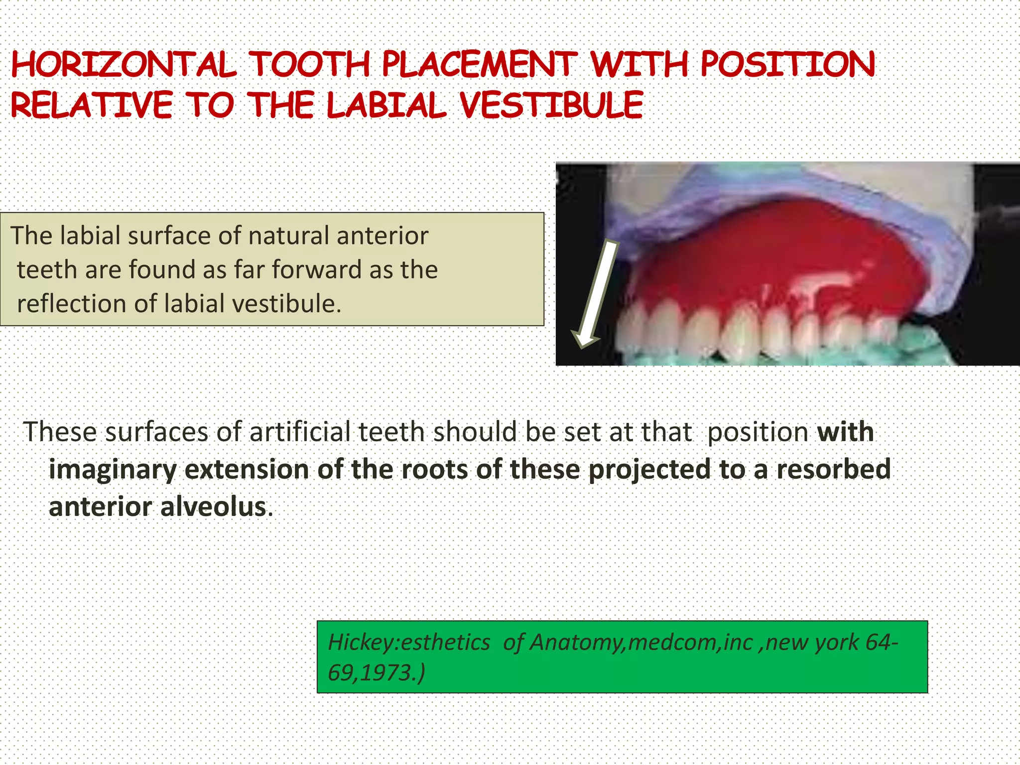 Esthetics in complete dentures dentogenic concept | PPTX