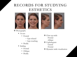 RECORDS FOR STUDYING
ESTHETICS
 Photographs
 At rest
• Frontal
− Lips relaxed
− Lips touching
• Profile
 Smiling
• Frontal
• Oblique
• Profile
 Close up smile
Frontal
oblique
 Cephalogram
Lateral
Frontal
 Dynamic smile visualization
 