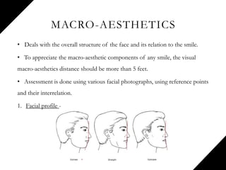 MACRO-AESTHETICS
• Deals with the overall structure of the face and its relation to the smile.
• To appreciate the macro-aesthetic components of any smile, the visual
macro-aesthetics distance should be more than 5 feet.
• Assessment is done using various facial photographs, using reference points
and their interrelation.
1. Facial profile -
 