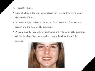 4. Facial Midline –
• In smile design, the starting point of the esthetic treatment plan is
the facial midline.
• A practical approach to locating the facial midline references the
nasion and the base of the philtrum.
• A line drawn between these landmarks not only locates the position
of the facial midline but also determines the direction of the
midline.
 