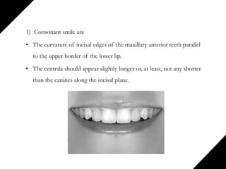 1) Consonant smile arc
• The curvature of incisal edges of the maxillary anterior teeth parallel
to the upper border of the lower lip.
• The centrals should appear slightly longer or, at least, not any shorter
than the canines along the incisal plane.
 