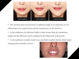 • The absolute linear measurement of philtrum height is not important, but its
relationship to the upper incisor and the commissures of the mouth is.
• In the adolescent, the philtrum height is often shorter than the commissure
height, and the difference can be explained in the differential in lip growth.
• A short philtrum in adults results in an unesthetic maxillary lip line which makes
resting posture resemble a frown.
 
