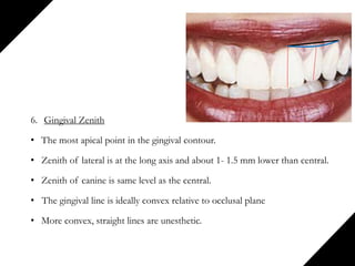 6. Gingival Zenith
• The most apical point in the gingival contour.
• Zenith of lateral is at the long axis and about 1- 1.5 mm lower than central.
• Zenith of canine is same level as the central.
• The gingival line is ideally convex relative to occlusal plane
• More convex, straight lines are unesthetic.
 
