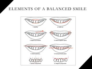 ELEMENTS OF A BALANCED SMILE
 