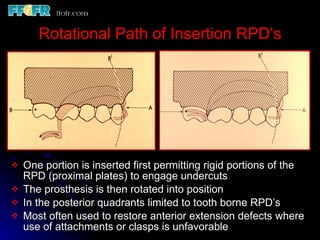 Esthetics, rotational path, attachments | PPT