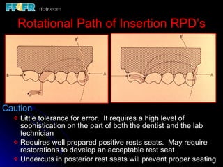Esthetics, rotational path, attachments | PPT