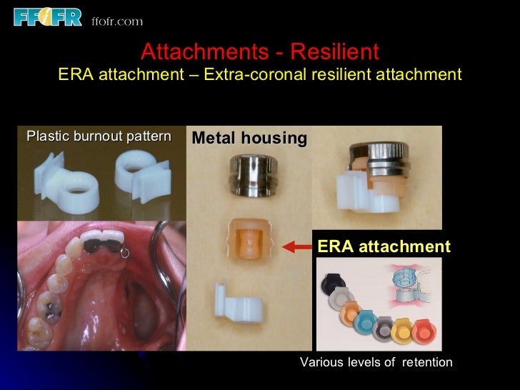 Esthetics, rotational path, attachments