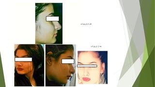 facial cosmetic surgery