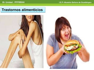Trastornos alimenticios
XI- Unidad : PFFRRHH I.E.P «Nuestra Señora de Guadalupe»