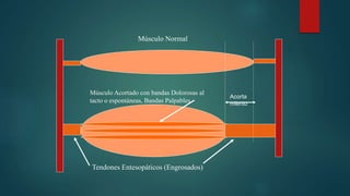 Músculo Normal
Músculo Acortado con bandas Dolorosas al
tacto o espontáneas, Bandas Palpables
Tendones Entesopáticos (Engrosados)
Acorta
miento
 