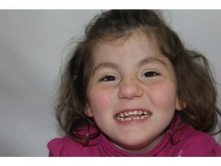 Estimulacion visual a los 4 años