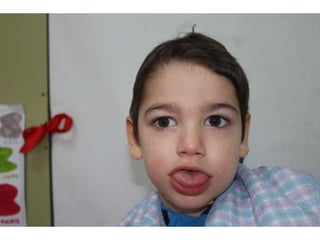 Estimulacion visual a los 4 años