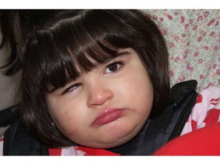 Estimulacion visual a los 4 años