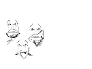 estlander.flap.ppt