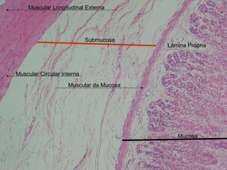 Submucosa Muscular da Mucosa Muscular Circular Interna Muscular Longitudinal Externa Mucosa Lâmina Própria 