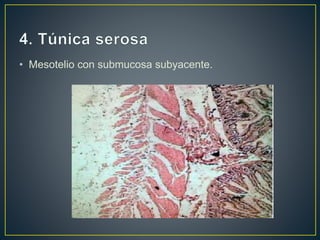 • Mesotelio con submucosa subyacente.
 