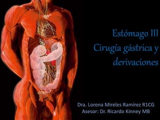 Estómago III
Cirugía gástrica y
derivaciones
Dra. Lorena Mireles Ramírez R1CG
Asesor: Dr. Ricardo Kinney MB
 