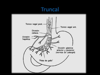 Truncal
 