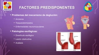FACTORES PREDISPONENTES
• Problemas del mecanismo de deglución:
• Ancianos
• Traqueostomizados
• Enfermedades neuromusculares
• Patologías esofágicas:
• Divertículo esofágico
• Lesión obstructiva
• Acalasia
 