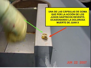 ENVOLTORIOS REVENTADOS Y QUE LE OCASIONARON LA MUERTE UNA DE LAS CÁPSULAS DE GOMA QUE POR LA ACCIÓN DE LOS JUGOS GÁSTRICOS REVENTÓ, OCASIONANDO LA DOLOROSA MUERTE DE JUAN X 