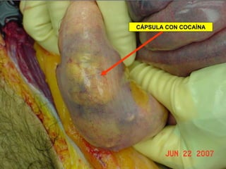 CÁPSULA CON COCAÍNA 